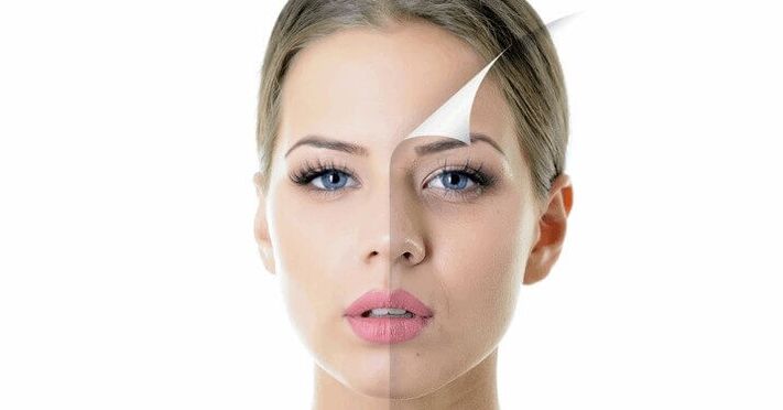 facial skin rejuvenation in women