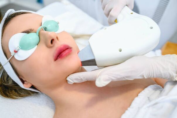 laser facial skin resurfacing procedure